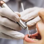 تحصیل دندانپزشکی در ایتالیا بدون آزمون: شرایط و هزینه‌ها
